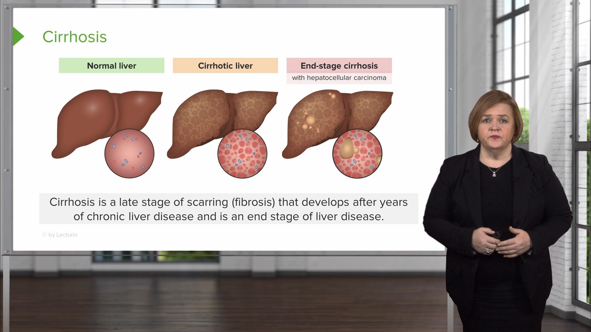 8-liver-cirrhosis-hepatic-cirrhosis-nursing-care-plans-nursing-care