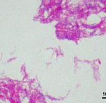 Mycobacterium bovis