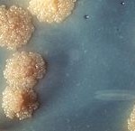 Kulturen von Mycobacterium tuberculosis auf Nährboden, vergrößert