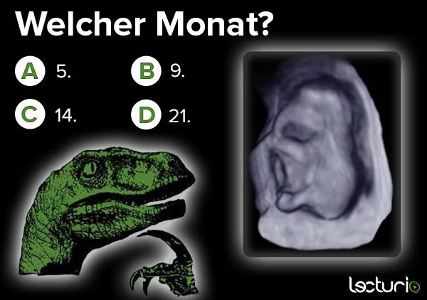 das ist ein quiz zu einem elefantenfoetus