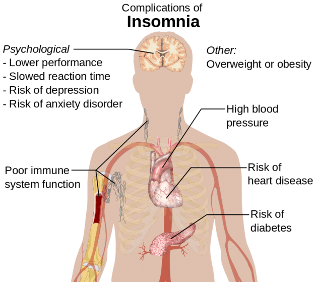Schlafstörungen Insomnia