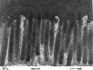 Elektronenmikroskopische Aufnahme der menschlichen Jejunum-Epithelzellen mit dicht gepackten Mikrovilli. Elektronenmikroskopische Aufnahme der menschlichen Jejunum-Epithelzellen mit dicht gepackten Mikrovilli.