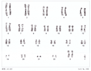 Chromosomen Typ XXY
