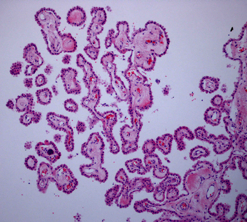 Choroid Plexus Histologie