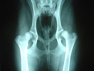 Röntgenaufnahme einer beidseitigen Hüftdysplasie