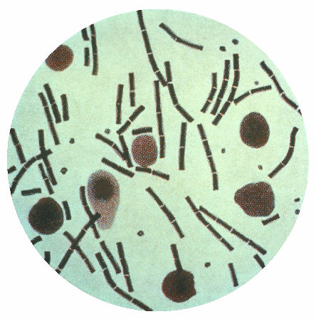 Bacillus anthracis in einer Hiss-Kapselfärbung