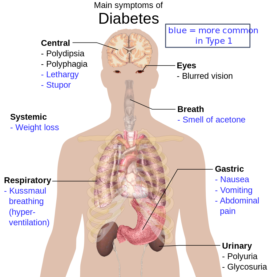 Diabetes Mellitus Zuckerkrankheit