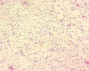 das ist ein mikroskopiebild von brucella spp