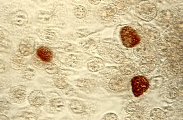das ist ein mikroskopiebild von chlamydia trachomatis Einschlusskörperchen