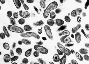 das ist ein mikroskopiebild von coxiella burnetii