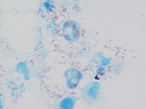 das ist ein mikroskopiebild von rickettsia conorii