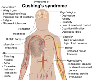 symptome des Cushing Syndroms