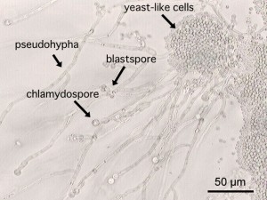 C.albicans in der Mikroskopie