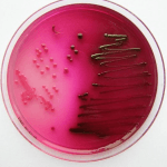 Escherichia-coli-auf-Endo-agar