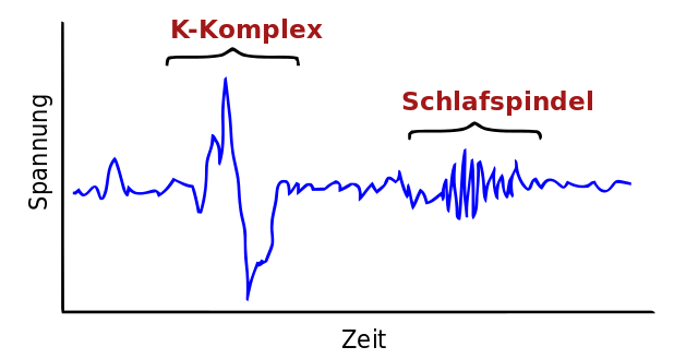 Fiktionelles EEG mit Schlafspindel und K-Komplex in Schlafstadium II