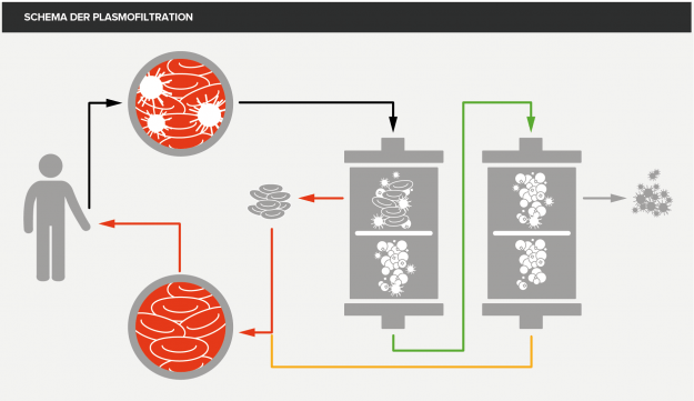 Diagramm von Plasmofiltration