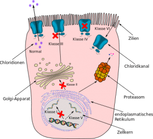 Schematische Darstellung der 6 verschiedenen Mutationsklassen bei Mukoviszidose (Zystische Fibrose)
