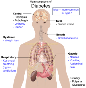 Symptome Diabetes
