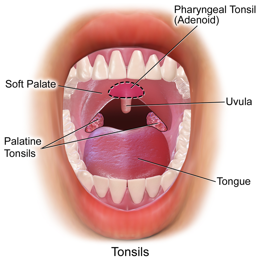 Erkrankungen Der Mundhohle Und Des Rachens Oropharynx