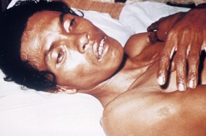 cholera-patient