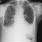 Medical X-rays.