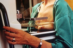 Diagnose durch Mammographie