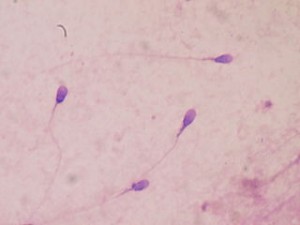 Eingefärbte Spermaprobe unter dem Lichtmikroskop