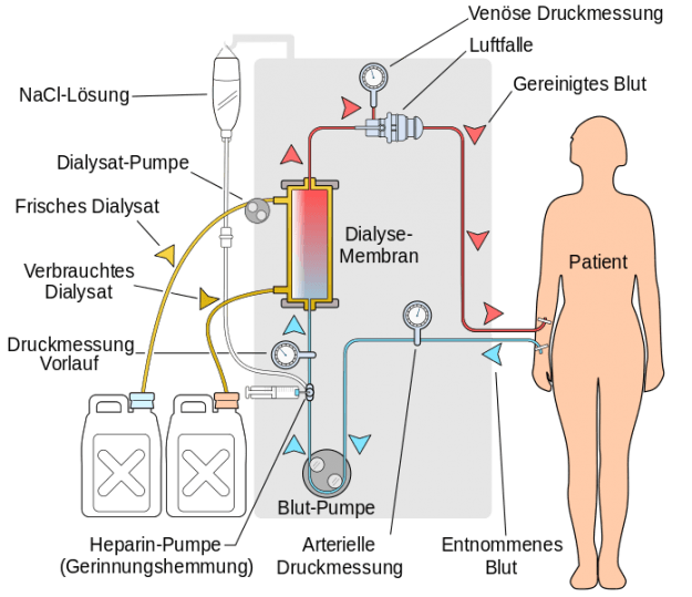Haemodialyse