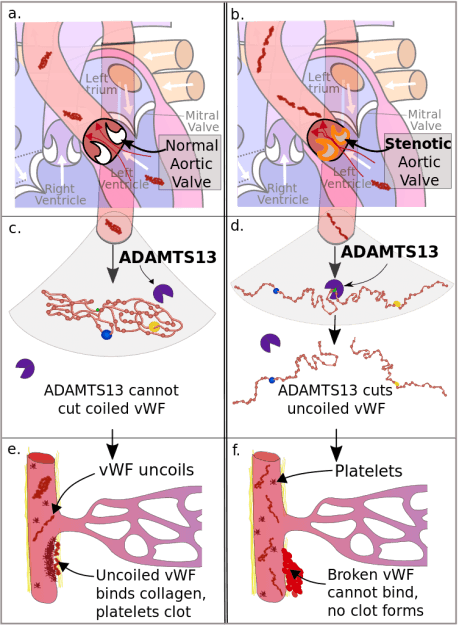 Heyde_Syndrom_Pathophysiologie