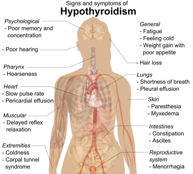 Anzeichen und Symptome der Hypothyreose