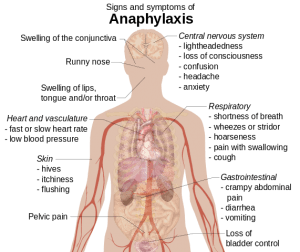 Symptome der Anaphylaxie