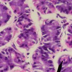 Parietal cells