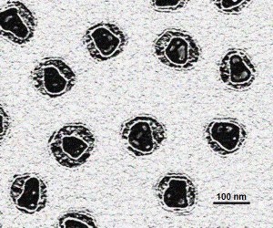HIV-elektronenmikroskopiebild