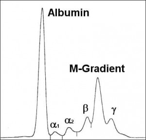 Serum-Elektophorese-IgA-Myelom