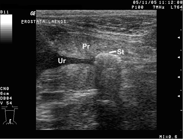 Ultraschallbild eines Harnsteins im Prostatateil der Harnröhre beim männlichen Hund. (Ur=Urethra (Harnröhre), Pr=Prostata, St= Harnstein)