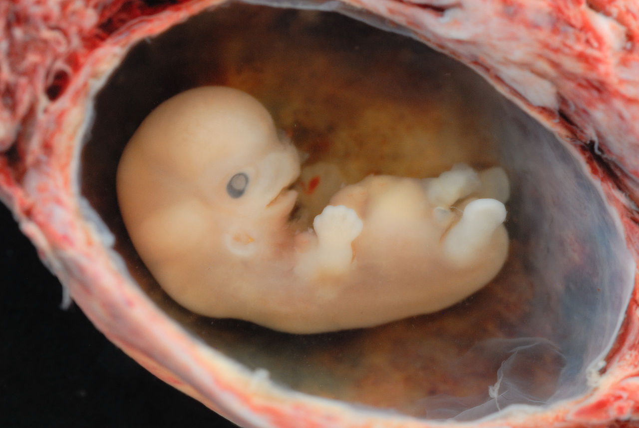 dieses bild zeigt einen embryo im bauch einer schwangeren
