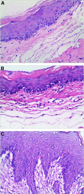 Ösophagus Histologie Ösophagus Histologie