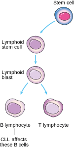 Von CLL betroffene Zellen Von CLL betroffene Zellen