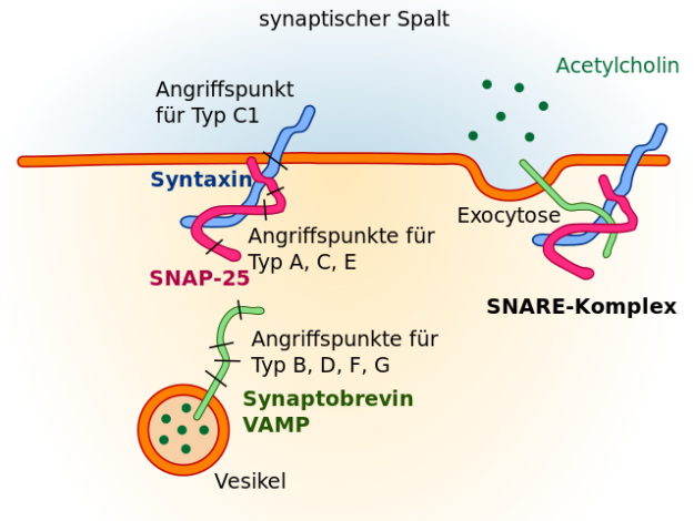 Schematische Darstellung der Angriffspunkte der verschiedenen Botulinumtoxintypen am SNARE-Komplex.