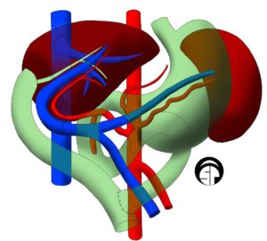 left liver transplant