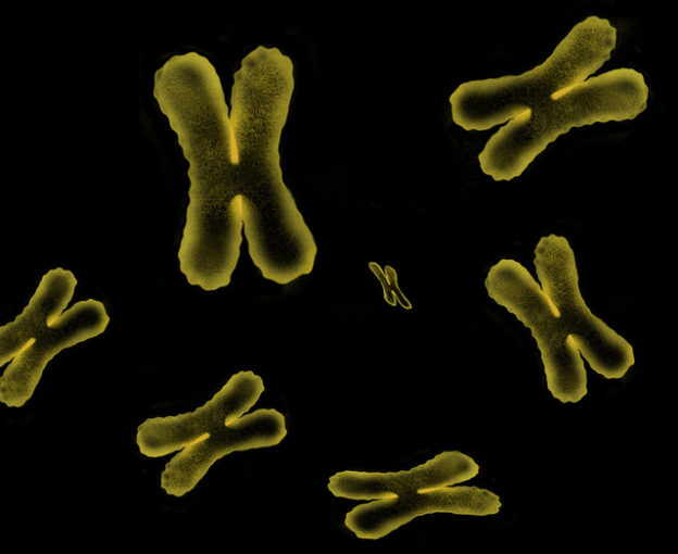 chromosomes-sex-linked-genetic-disorders
