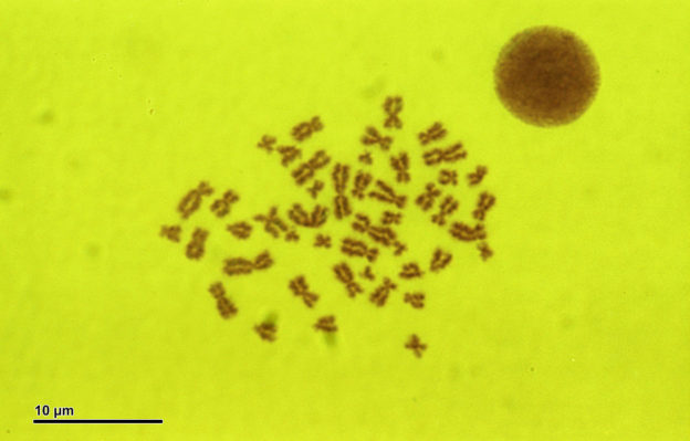 Karyotype human 46,XX (woman)
