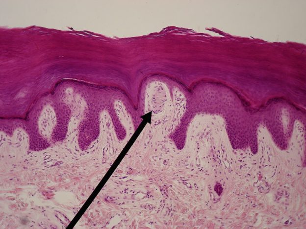 meissners corpuscle