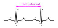 How to Interpret an ECG in Seven Steps | Online Medical Library