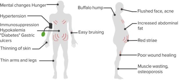 Cushingoid-Symptoms
