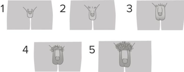 Normal-Puberty-Male