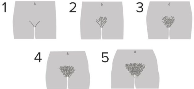 Normal-Puberty-Female