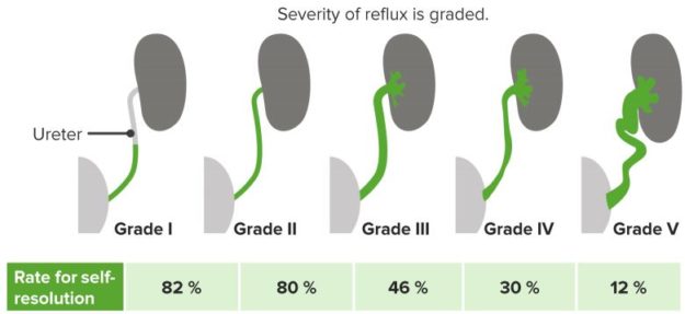 Vesicoureteral-Reflux
