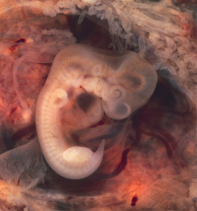 Photo of Embryo