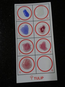 Widal Test Slide